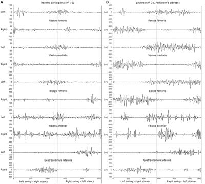 Evaluation of Three Machine Learning Algorithms for the Automatic Classification of EMG Patterns in Gait Disorders